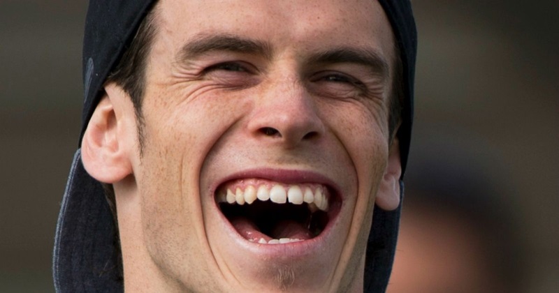 cầu thủ răng thỏ